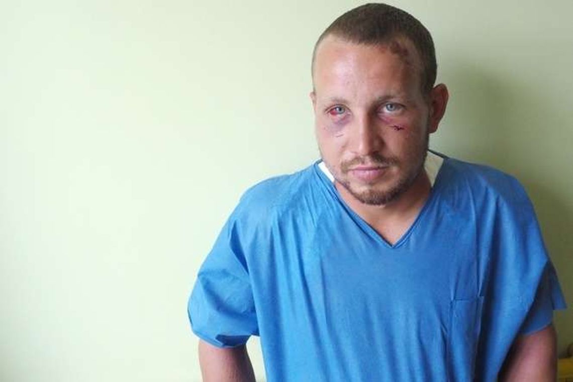 Brutalny atak na kolejnego Ukraińca w Lublinie. Usłyszał: "Po coś tu przyjechał się rządzić?"