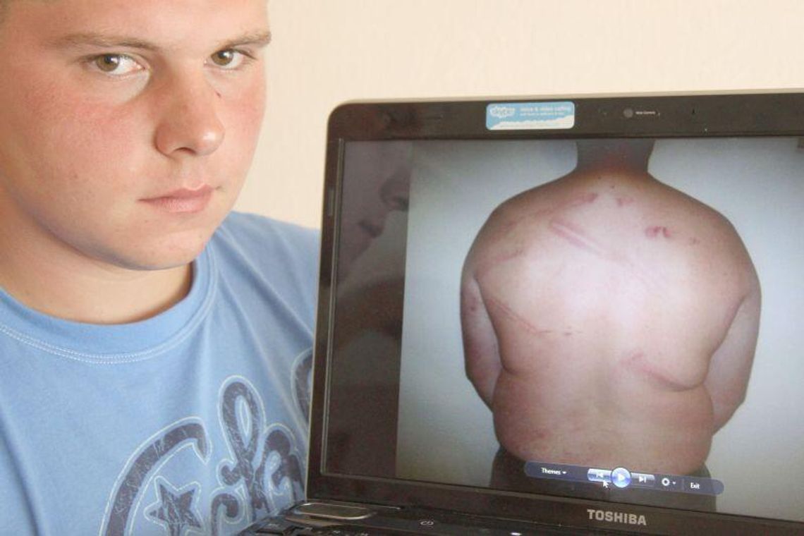 Czy policjanci pobili Mateusza? Śledztwo umorzone z braku dowodów