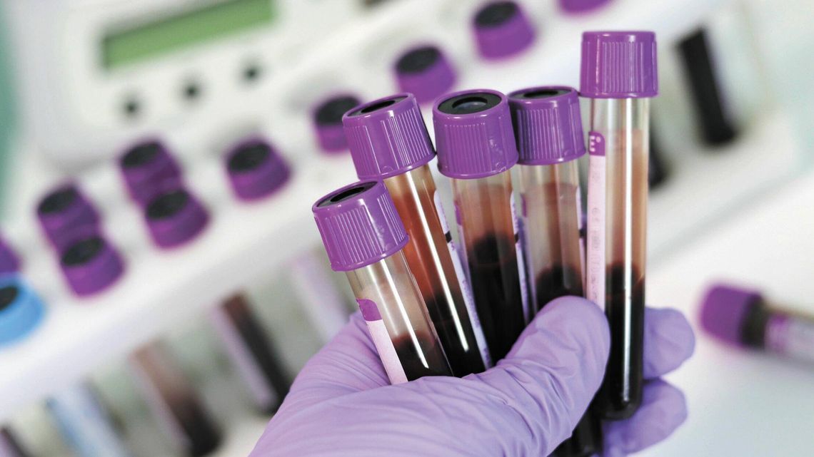 Groźna choroba, o której mało kto wie. Demoluje wątrobę