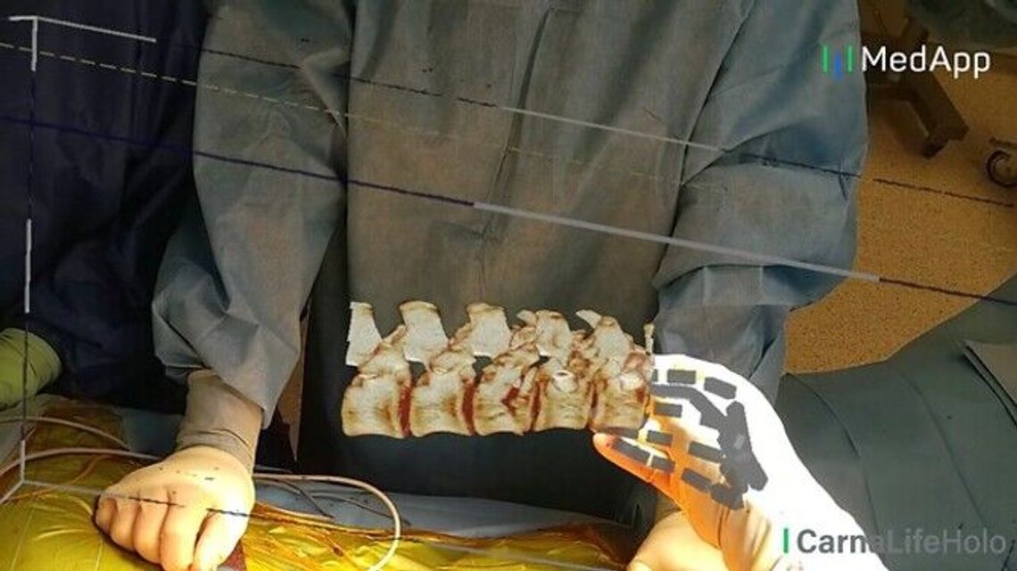 Hologramy i gogle. Tak lubelscy lekarze zoperowali kręgosłup Hologramy i gogle. Tak lubelscy lekarze zoperowali kręgosłup