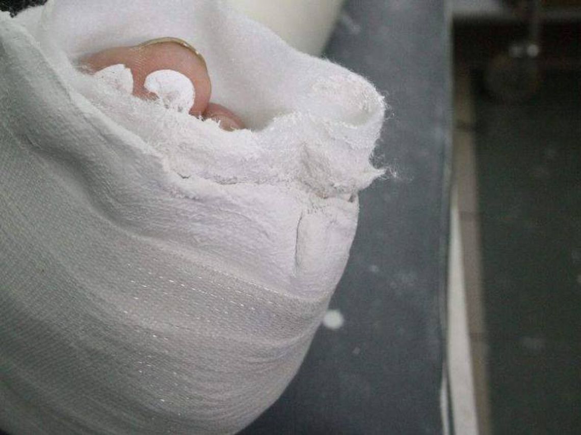 Hrubieszów: Matka biegła na pomoc dziecku i złamała nogę