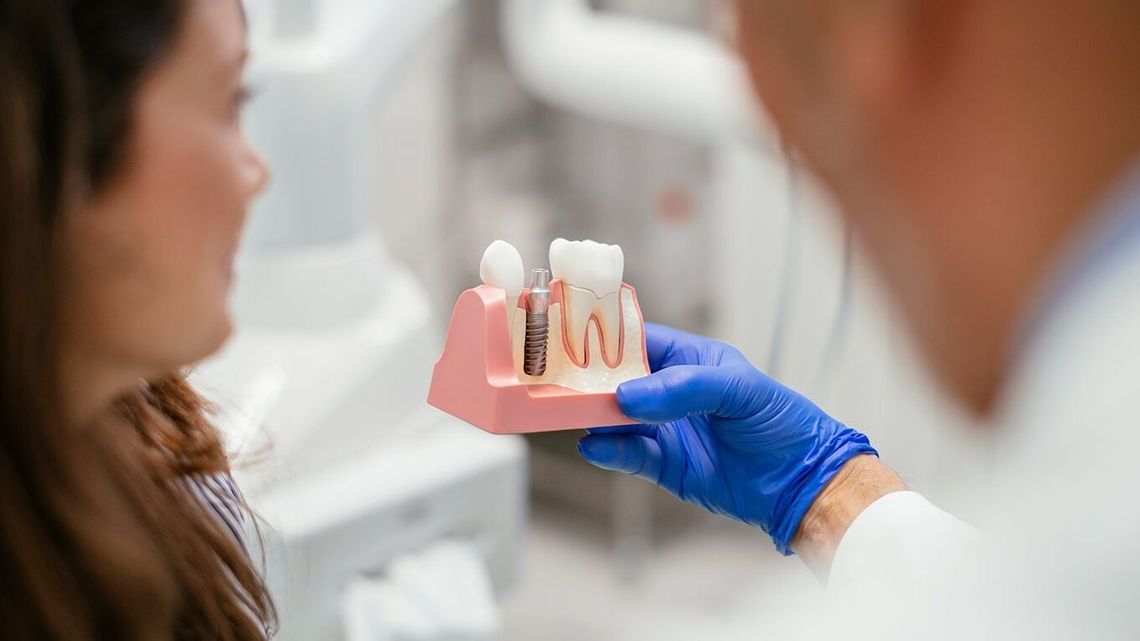 Implanty zębów. Czemu nie warto ryzykować z przypadkowymi gabinetami?