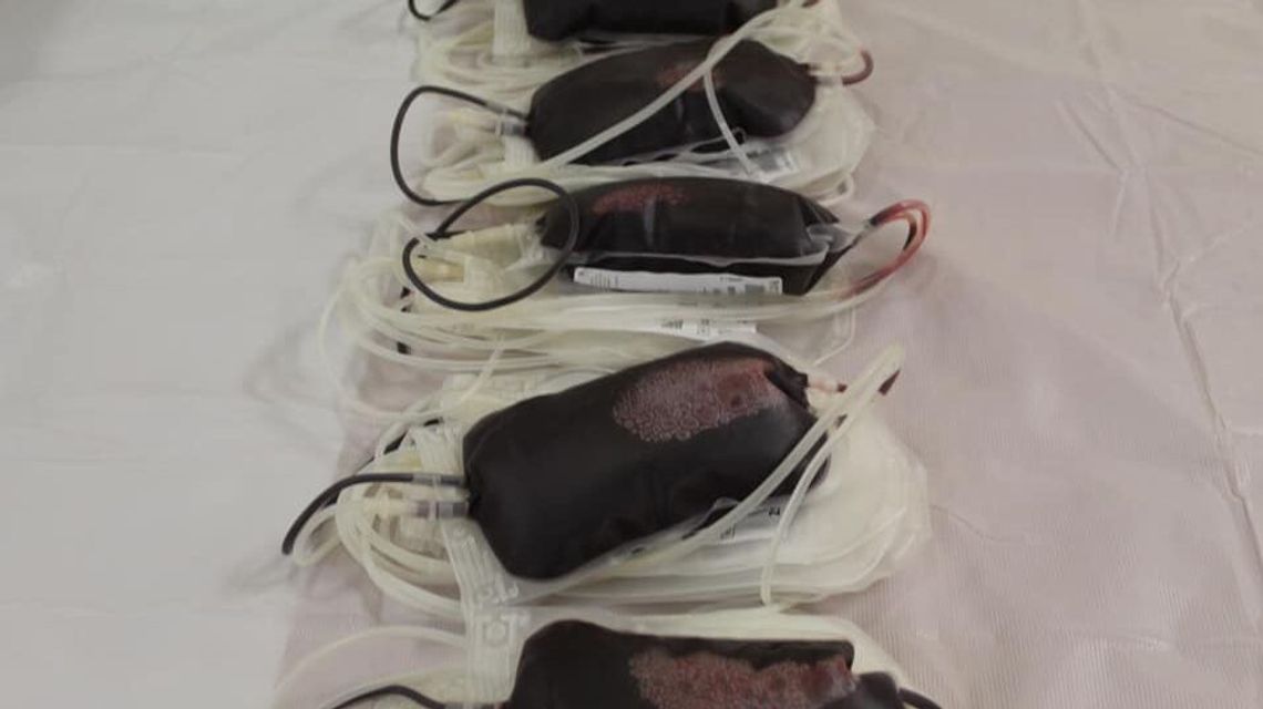 Jednej grupy krwi jest nadmiar, dwóch innych brakuje. Będą akcje w terenie Jednej grupy krwi jest nadmiar, dwóch innych brakuje. Będą akcje w terenie