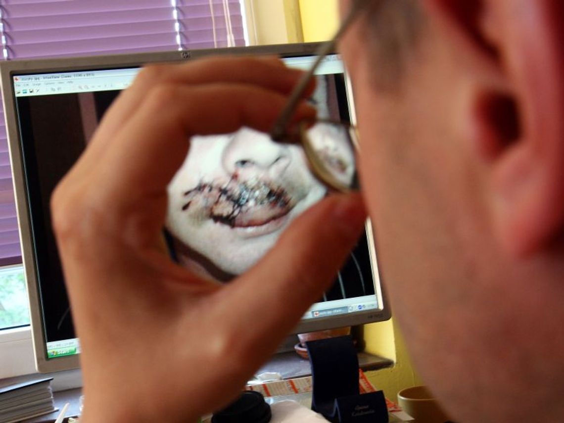 Kibic ze zmasakrowaną twarzą. Czy został trafiony policyjną kulą? Kibic ze zmasakrowaną twarzą. Czy został trafiony policyjną kulą?