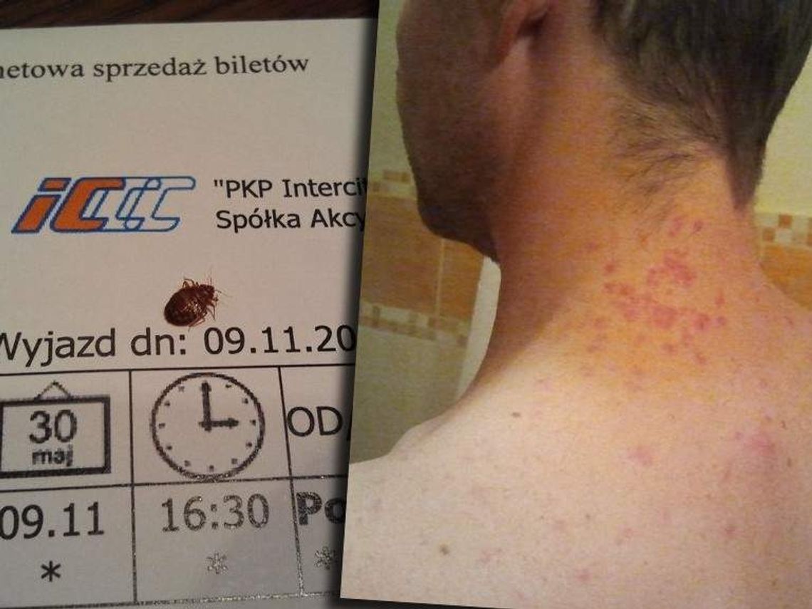 Koszmar w pociągu. Pluskwy dotkliwie pokąsały pasażera