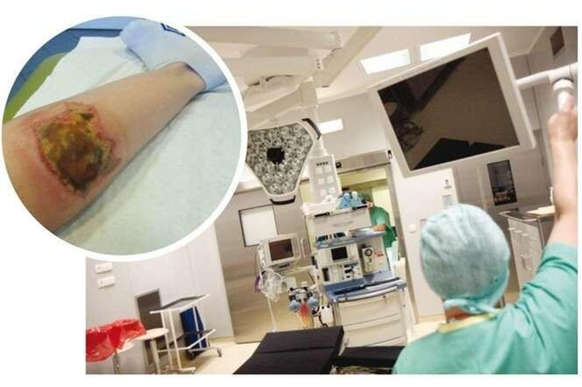 Leczyli nos, poparzyli nogę. "Zostałam trwale oszpecona w szpitalu w Lublinie"