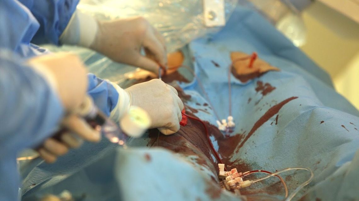 Lubelskie. Pacjentka po operacji została z chustą w brzuchu Lubelskie. Pacjentka po operacji została z chustą w brzuchu