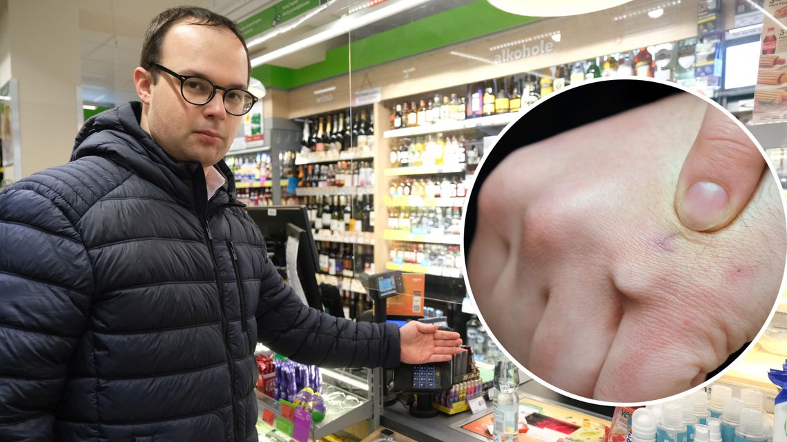 Lublin: Człowiek wchodzi do sklepu i płaci ręką. Implant płatniczy mają w Polsce 33 osoby [wideo]