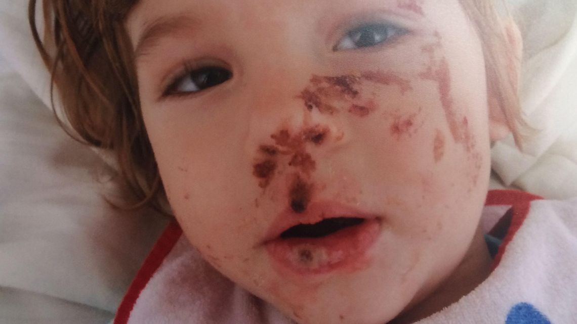 Mała Julia aż piszczy z bólu. Szansą dla niej jest leczenie w Niemczech