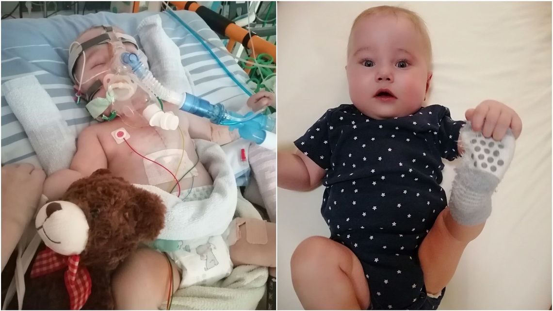 Mały Marcinek z Anusina walczy o życie w klinice w Niemczech. Rodzice zbierają na leczenie