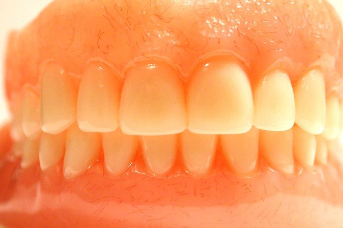 Mąż ukradł żonie protezę zębową