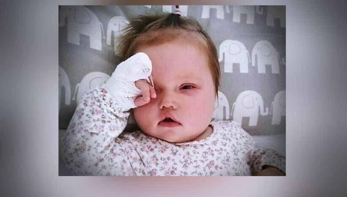 Nagle małej Marysi zaczęły migotać oczka. Dziewczynka z Lublina potrzebuje pomocy