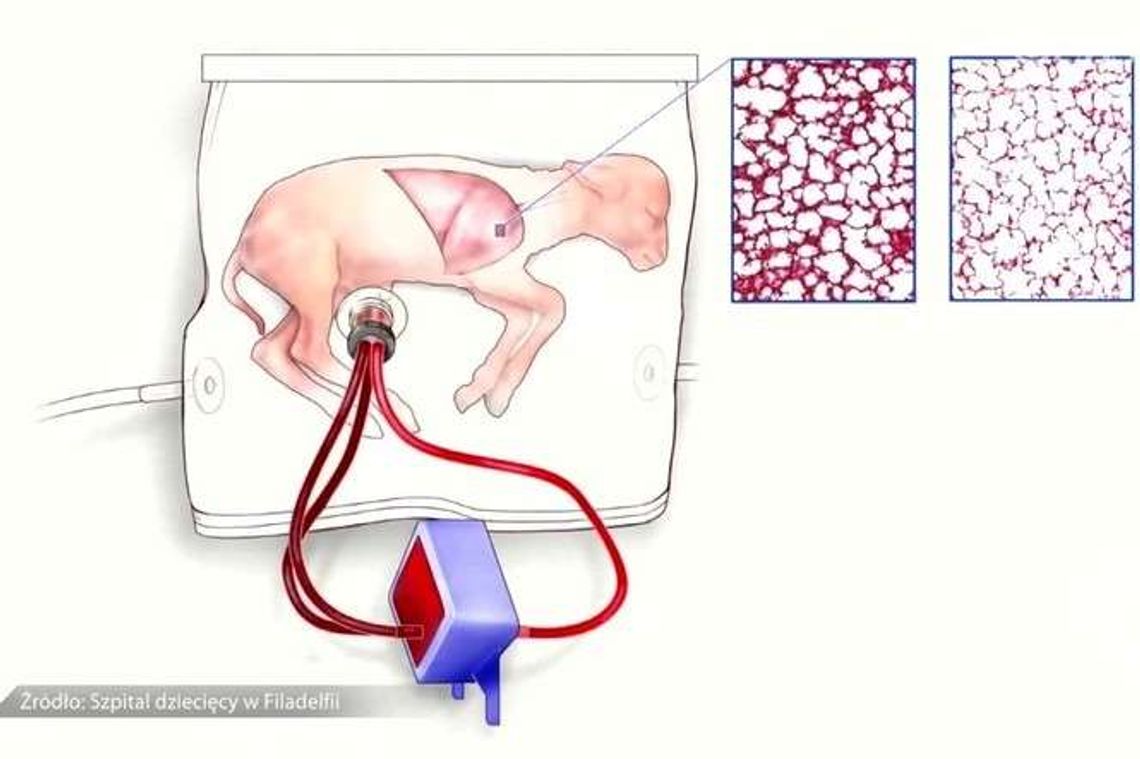 Naukowcy stworzyli sztuczną macicę. Urządzenie przetestowano na owcach