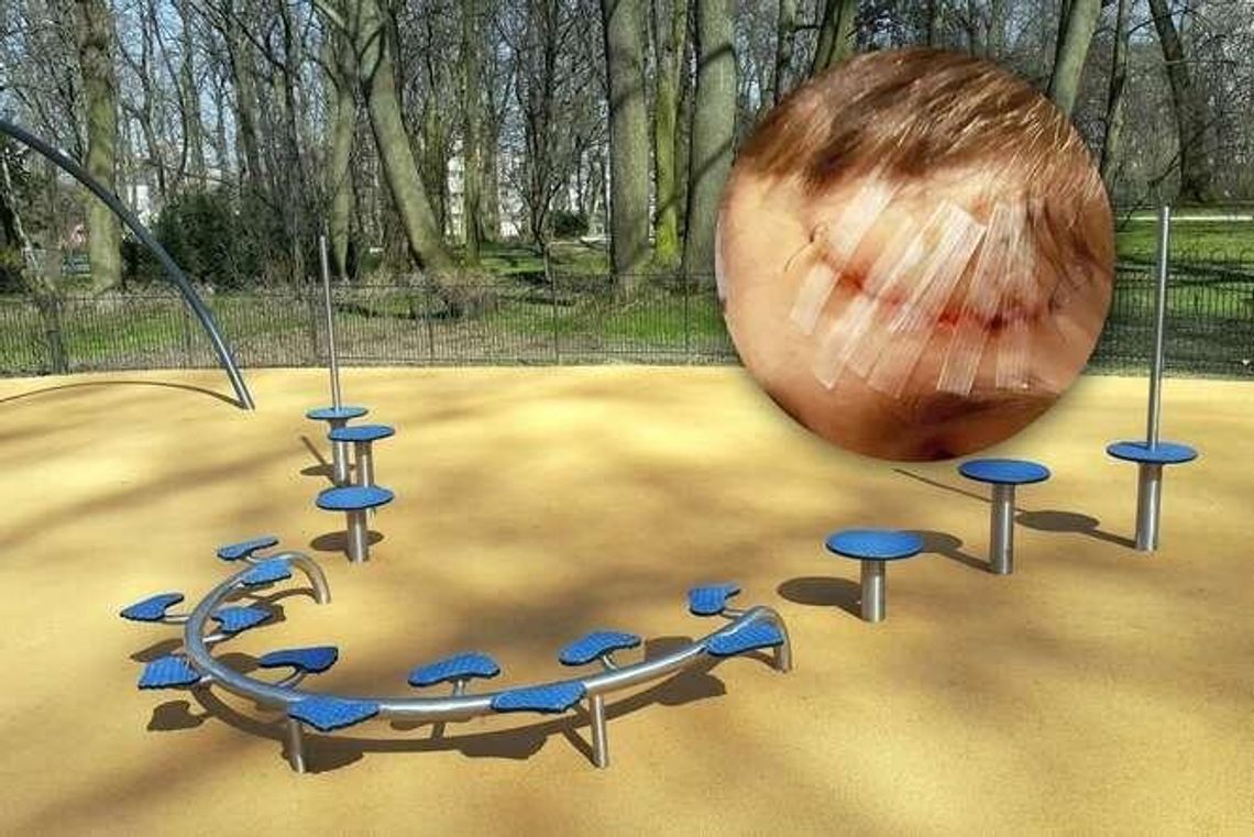 Niebezpieczny plac zabaw w Ogrodzie Saskim? "Syn trafił do szpitala"
