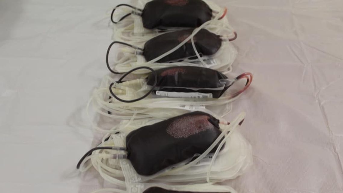 Niech poleje się krew. Sprawdź, gdzie można ją oddać (harmonogram)