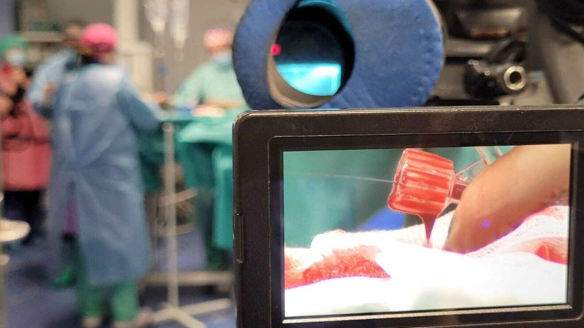 „Odkurzacz” w żyle pacjenta. Lekarze z Lublina operują tak pierwsi w Polsce „Odkurzacz” w żyle pacjenta. Lekarze z Lublina operują tak pierwsi w Polsce