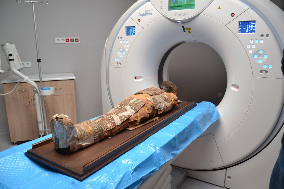 Pacjent ma 2 tysiące lat. Lubelscy lekarze „prześwietlili” egipską mumię