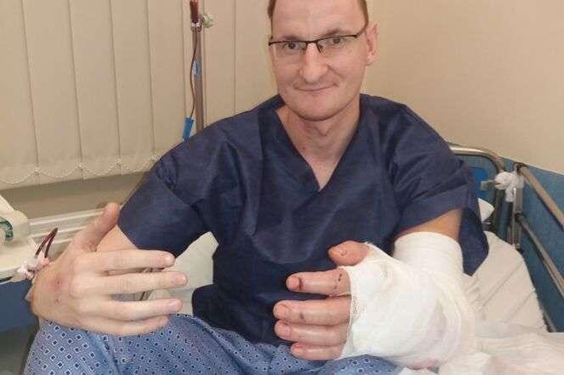 Pan Piotr urodził się bez ręki. Przeszczepili mu ją lekarze. "Wszyscy gratulowali mi odwagi"