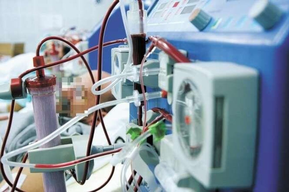 Pielęgniarka źle podłączyła "sztuczną nerkę"? Mężczyzna wykrwawił się i zmarł