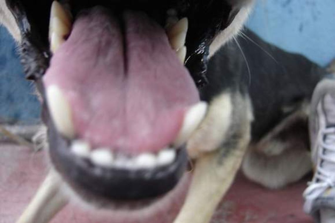 Pies pogryzł 2-latka. Dziecko trafiło do szpitala