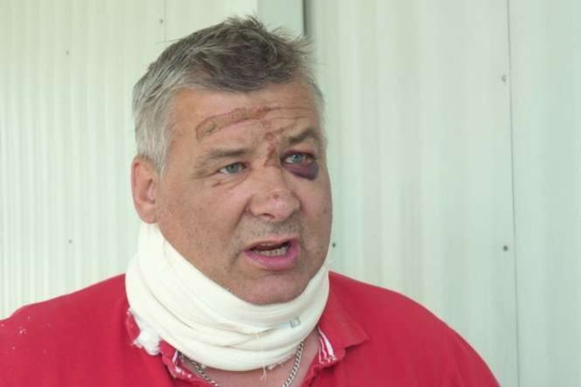 "Pobili mnie, gdy w nocy łapałem pokemony". Ma uszkodzony kręgosłup i połamane żebra