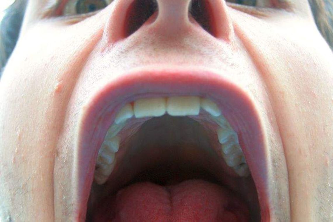 Podszedł do stolika i ugryzł mężczyznę w ucho. Lekarze musieli je zszyć