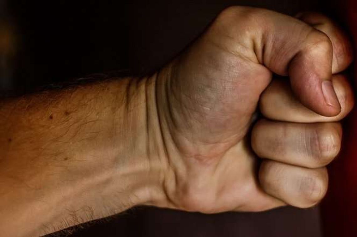 Pokłócili się o to kto robi lepsze wędliny. 52-latek z obrażeniami trafił do szpitala Pokłócili się o to kto robi lepsze wędliny. 52-latek z obrażeniami trafił do szpitala