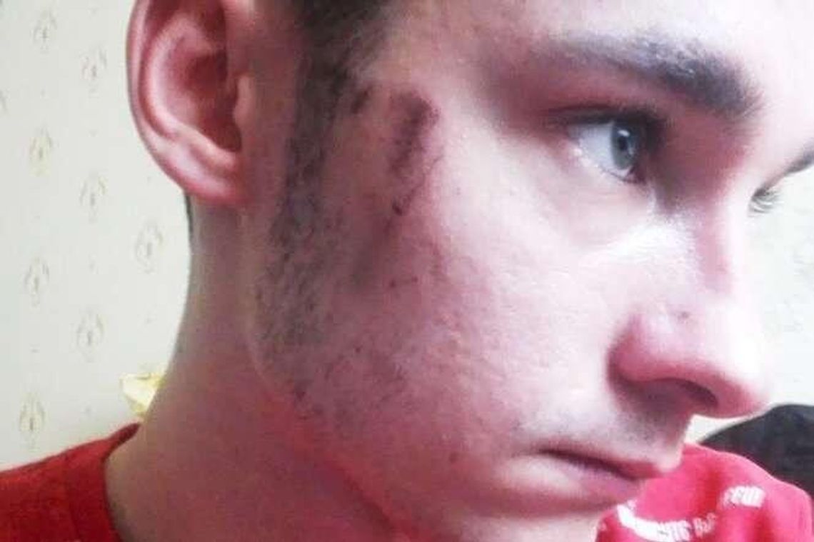 Policjanci zatrzymali go, bo miał damską torebkę. Kto był agresywny? Są ustalenia śledczych