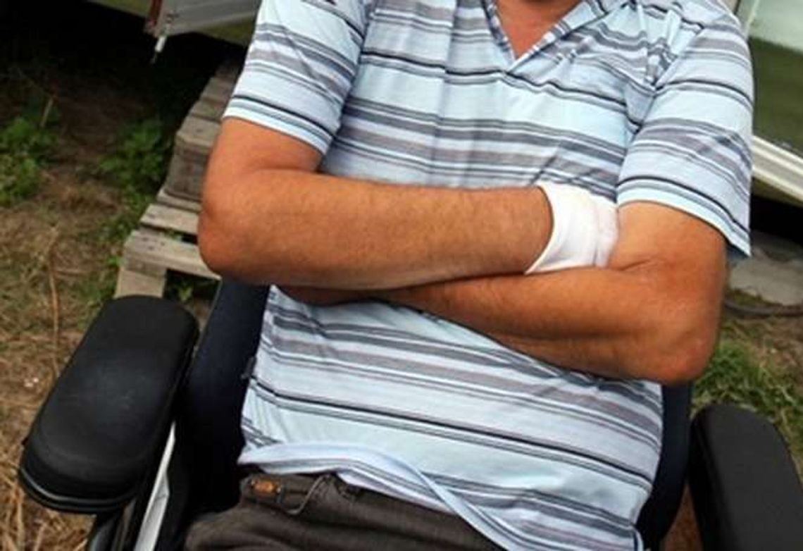 Potrzebna pomoc. Stracił obie nogi, zbiera na protezy