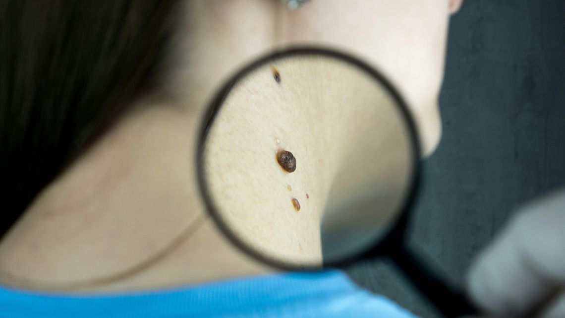 Potrzebny dermatolog? Sprawdź kogo polecają zadowoleni pacjenci