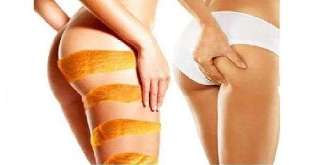 Proste i skuteczne sposoby na cellulit