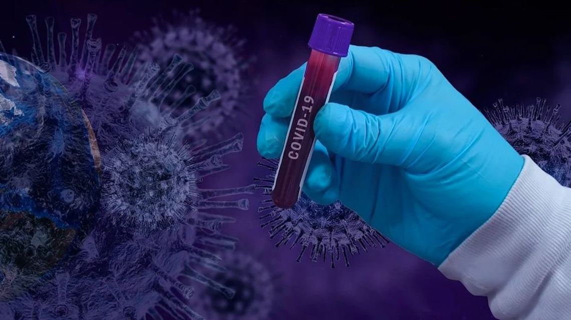 Przygotowania do masowej produkcji szczepionek przeciwko COVID-19 już trwają