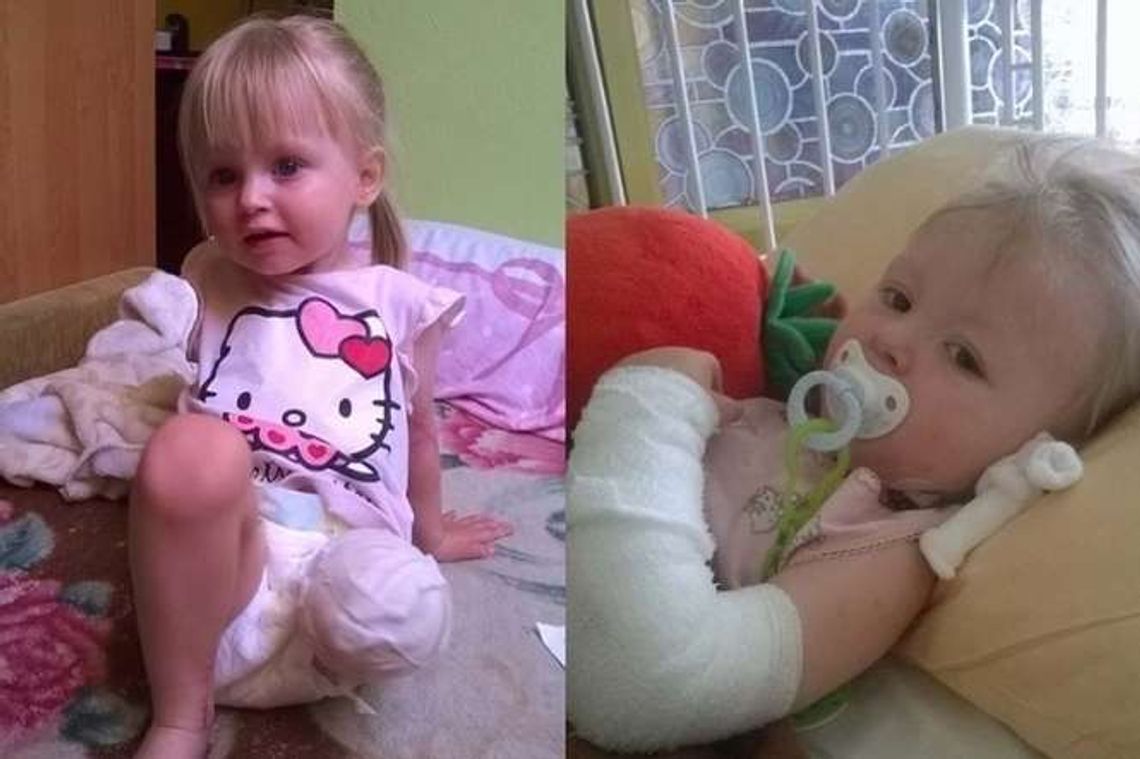 Rekordowo szybka pomoc dla Natalki, która straciła nóżkę. Suma ciągle rośnie