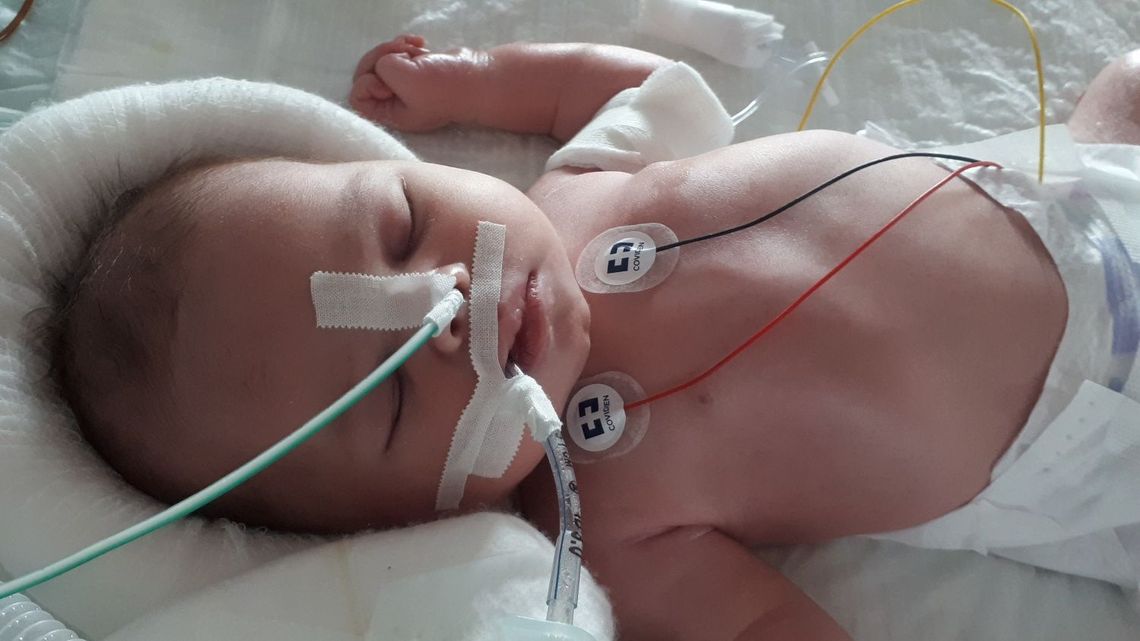 Rodzice Elizy zbierają na jej leczenie. Walczą też o zadośćuczynienie od szpitala w Parczewie