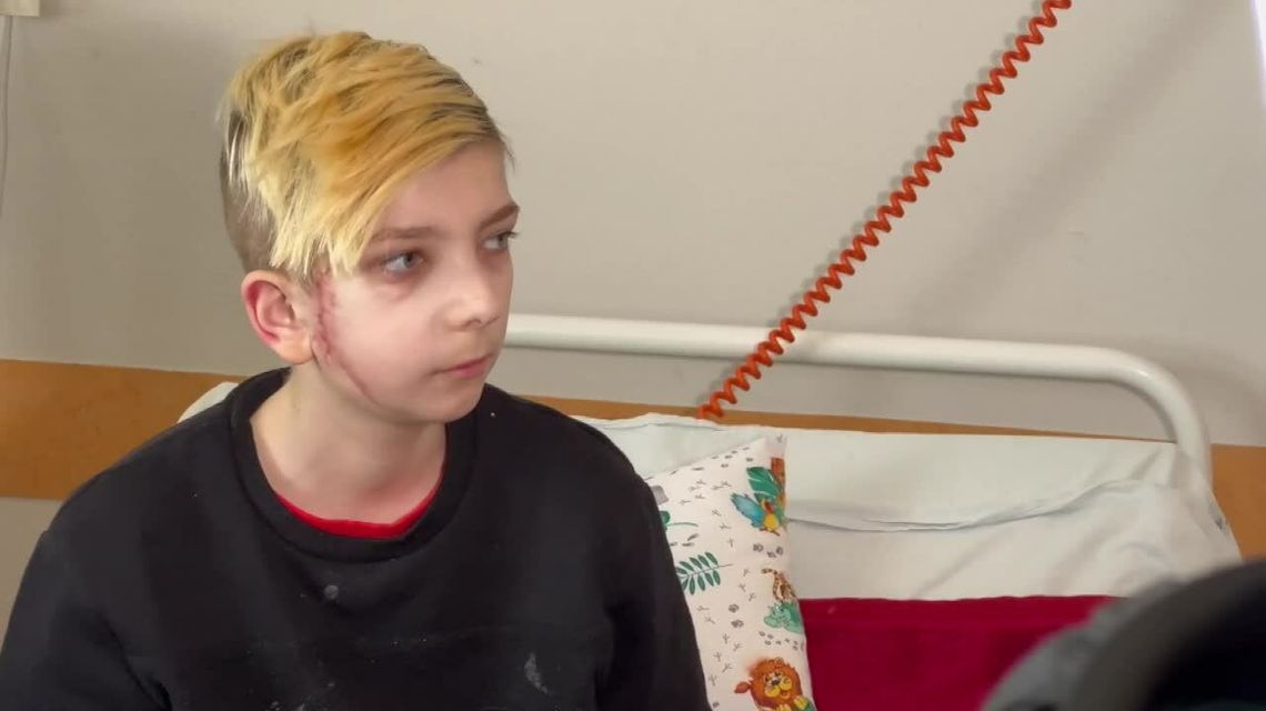 Rosjanie ostrzelali samochód, tata Wowy zginął na miejscu. Ranny 13-latek wraca do zdrowia w Polsce