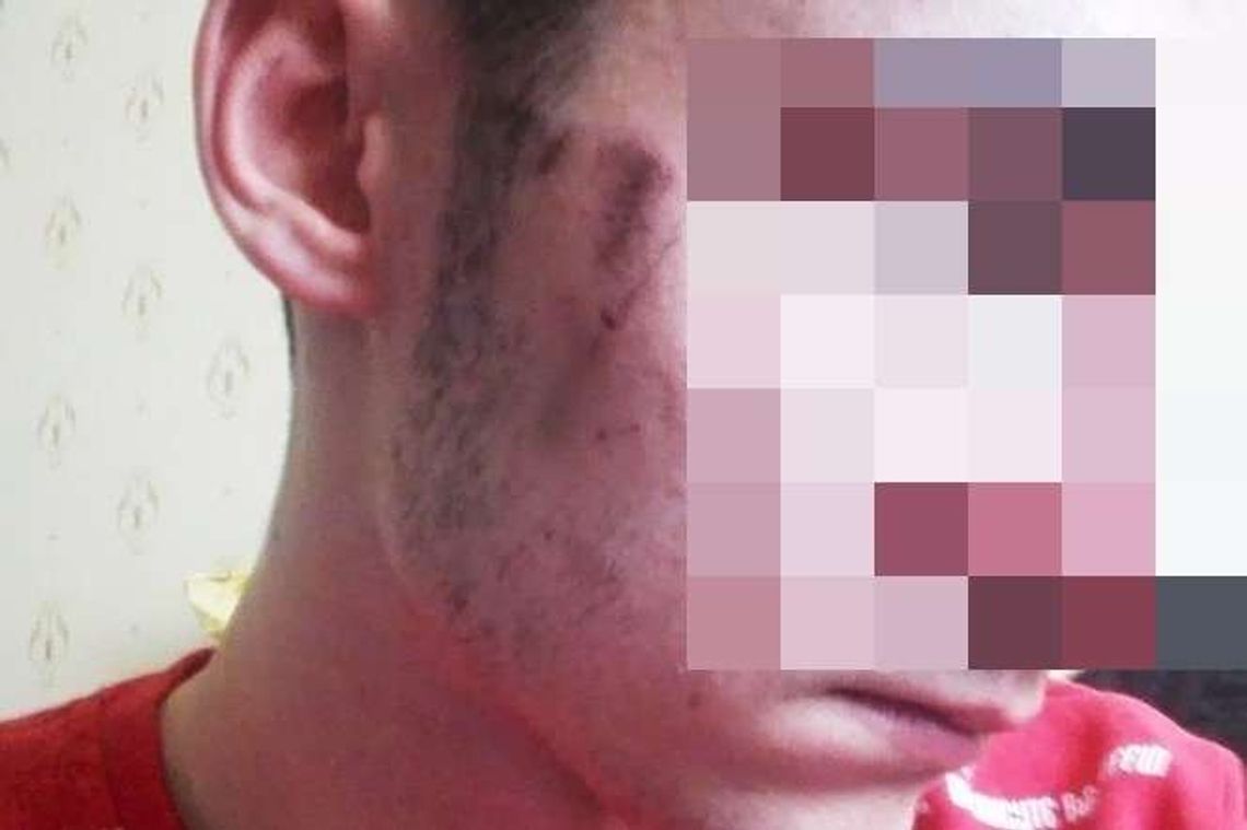 "Sam spowodował u siebie obrażenia". Śledztwo umorzone