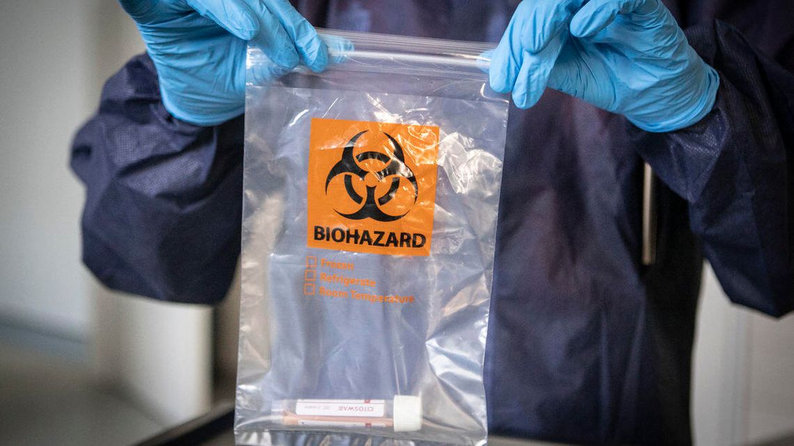 Starostowie nie otrzymują już danych o COVID-19. Dyskusja o raportach na radzie pow. świdnickiego Starostowie nie otrzymują już danych o COVID-19. Dyskusja o raportach na radzie pow. świdnickiego