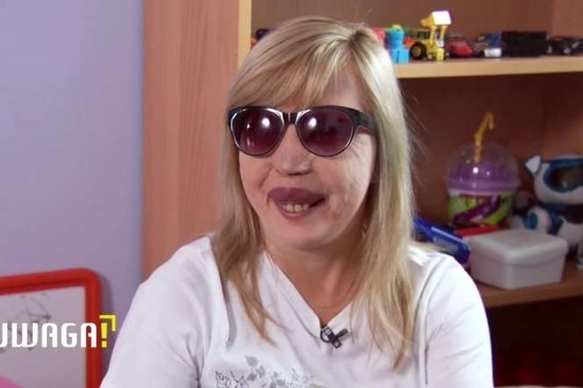 Straciła wzrok i pracę. "Miałam nadzieję, że ZUS się zachowa inaczej"