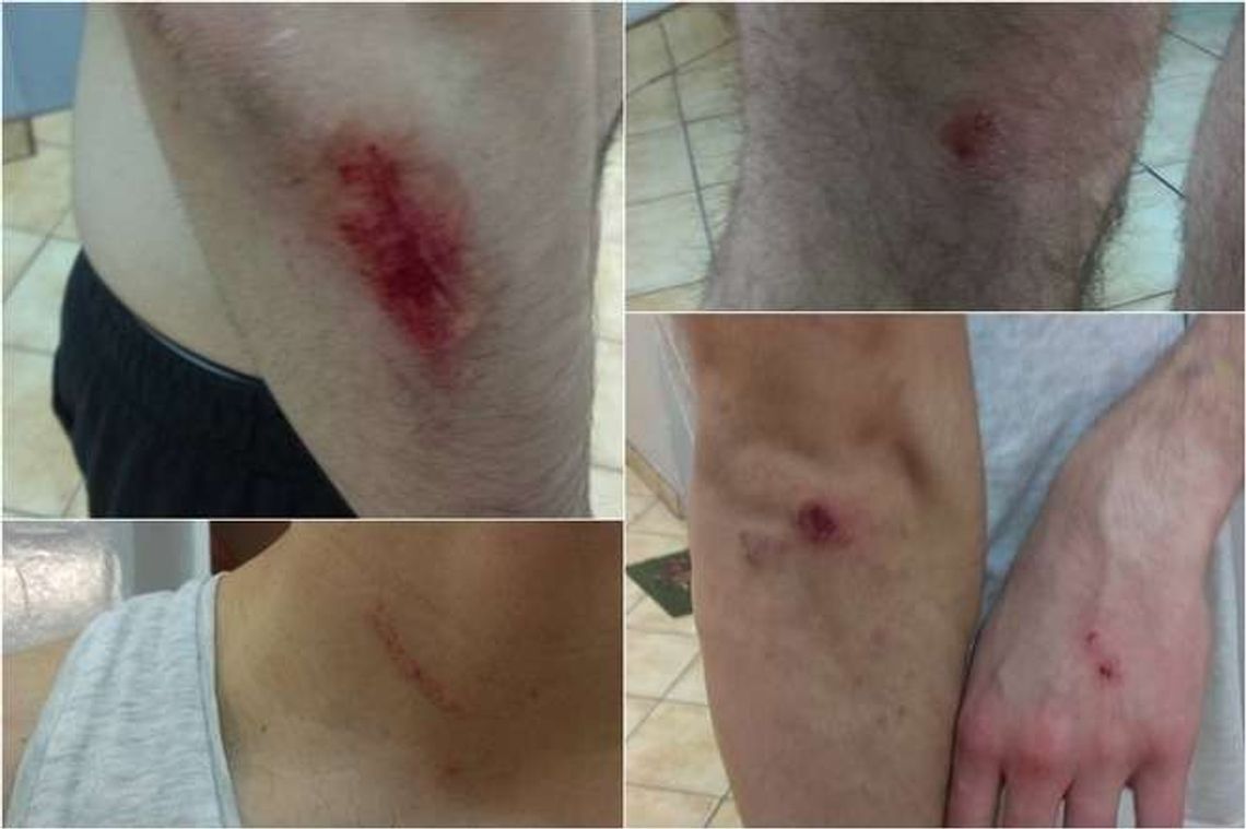 Student Politechniki Lubelskiej z Turcji pobity koło baru przy ul. Nadbystrzyckiej. "Padłem ofiarą rasistowskiej napaści"