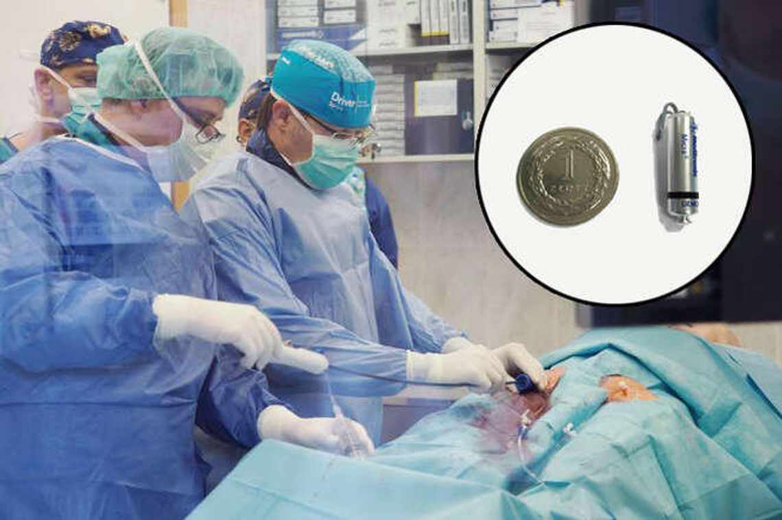 W Lublinie wszczepili najmniejsze na świecie stymulatory serca