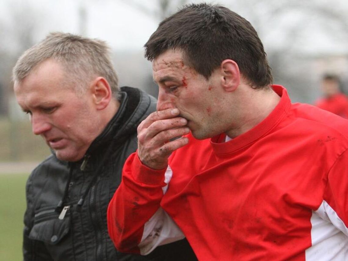 Walka, krew i złamany nos w meczu czwartej ligi