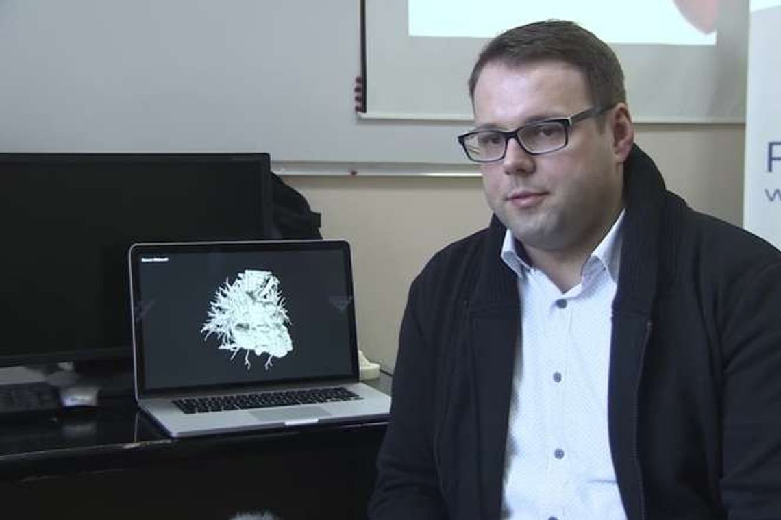 Wydrukował serce swojemu synkowi. Teraz pomaga innym dzieciom