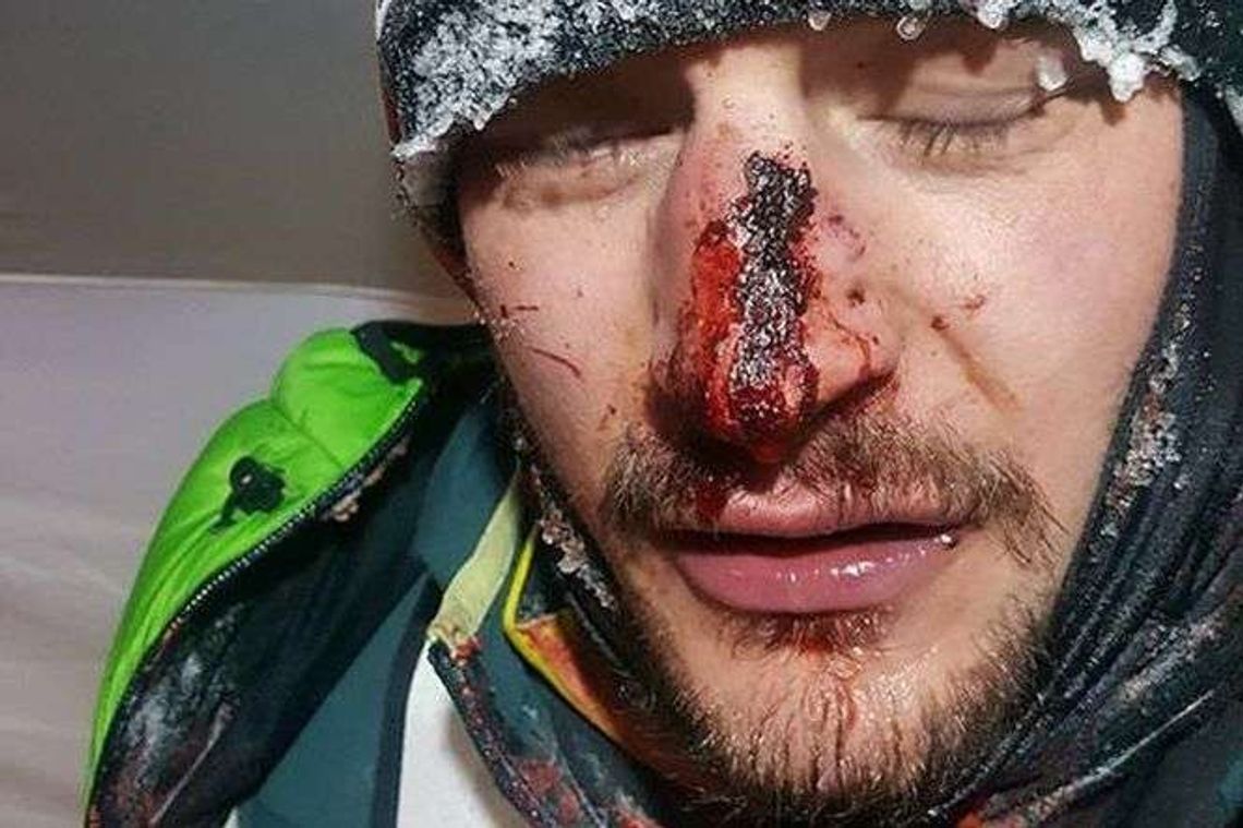 Wyprawa na K2. Adam Bielecki miał wypadek