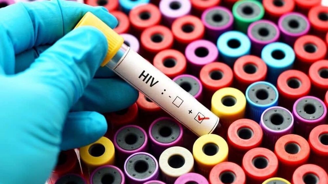 Wzrost zakażeń wirusem HIV. Na uczelni będzie można zrobić szybki test Wzrost zakażeń wirusem HIV. Na uczelni będzie można zrobić szybki test