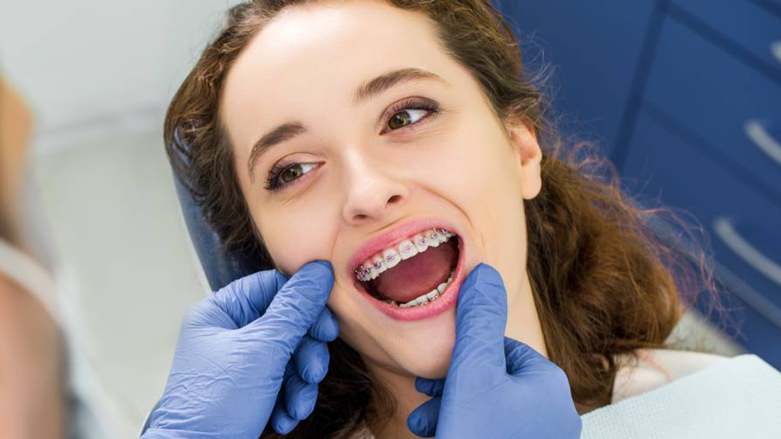 Z życia z aparatem – jak wygląda codzienność pacjenta ortodontycznego? Z życia z aparatem – jak wygląda codzienność pacjenta ortodontycznego?