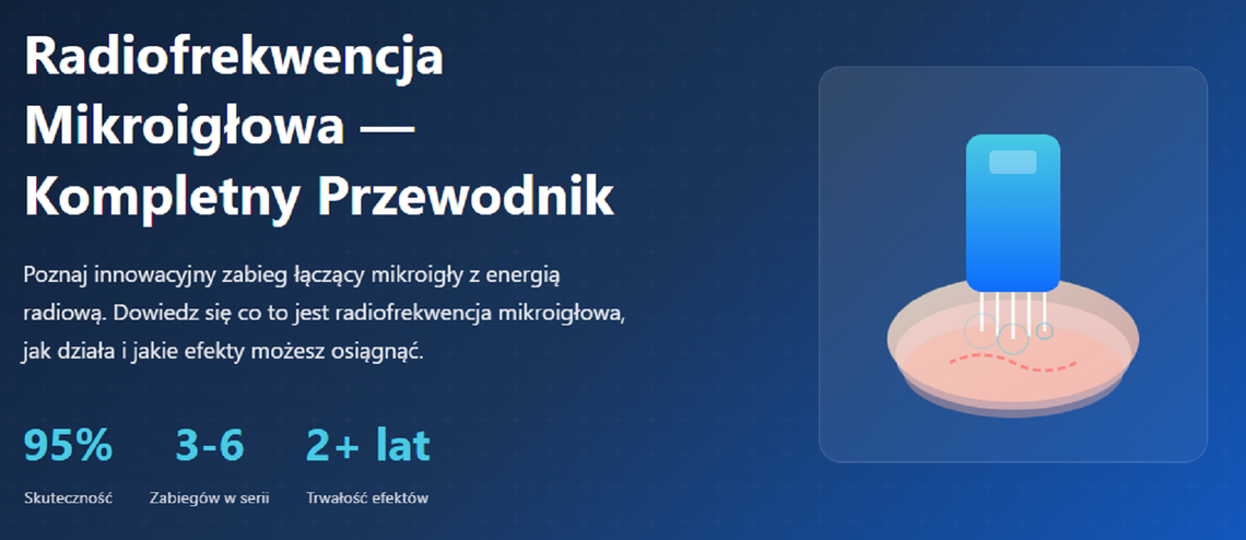 Zapomniana szyja i dekolt – Jak przywrócić im jędrność dzięki radiofrekwencji mikroigłowej?