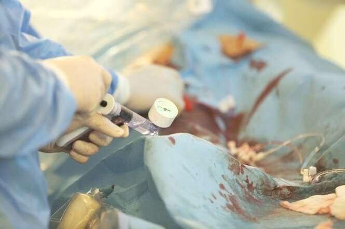 Zmiany w finansowaniu zabiegów kardiologicznych. "Cofniemy się o kilka lat"