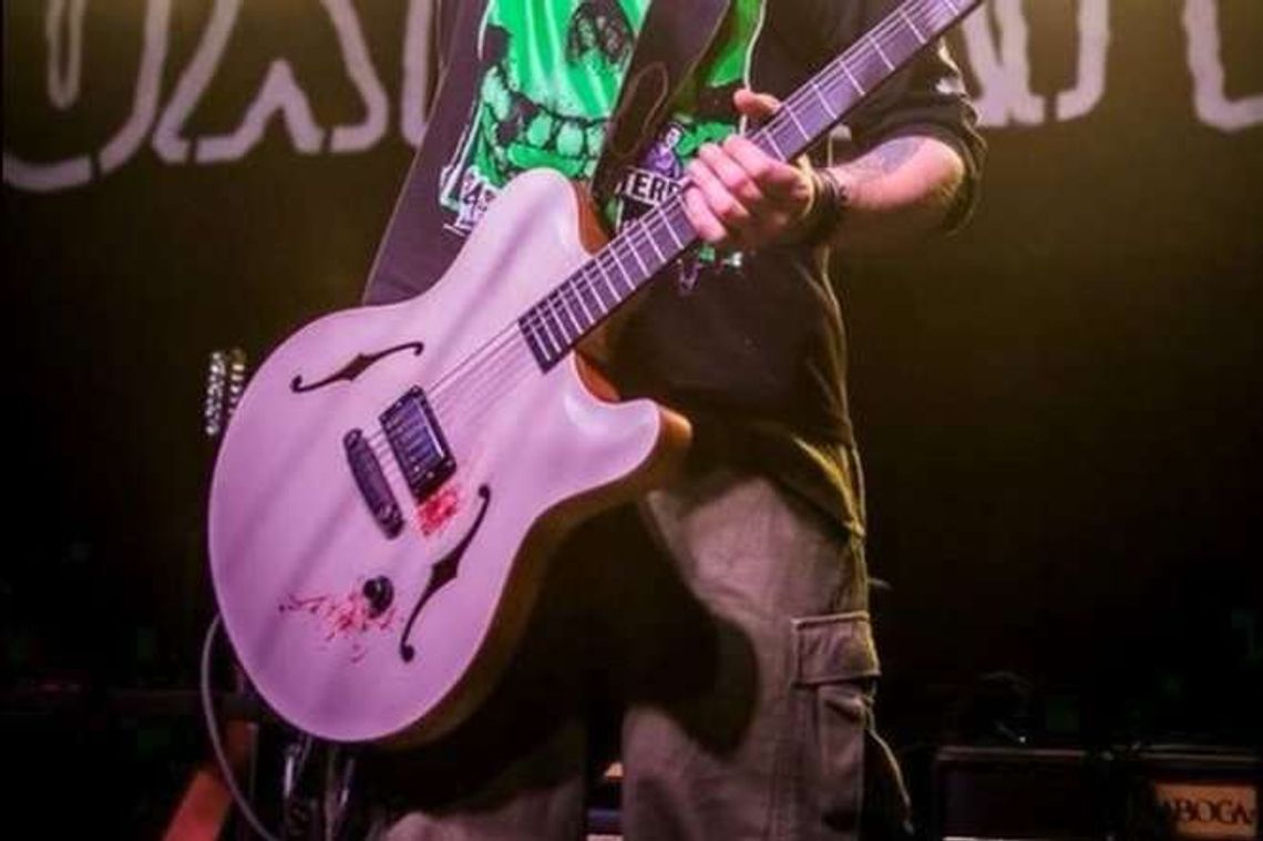 Znany polski muzyk spadł ze sceny. 5 złamanych żeber