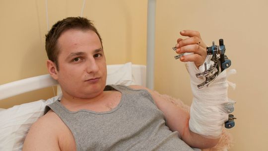 Lekarze z Łęcznej uratowali mu rękę Lekarze z Łęcznej uratowali mu rękę