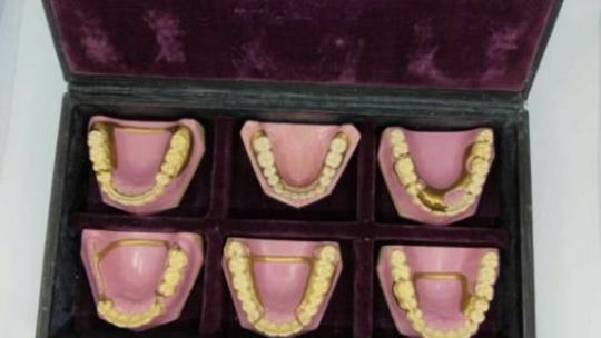 Eksponaty stomatologiczne z kolekcji dr Piotra Kuźnika Eksponaty stomatologiczne z kolekcji dr Piotra Kuźnika